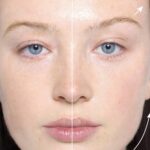 فیس اسکالپت Refy Beauty