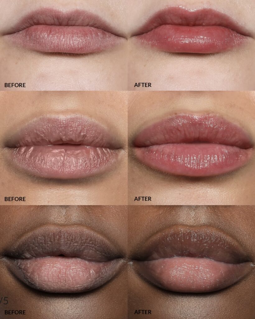 لیپ باف Refy Beauty