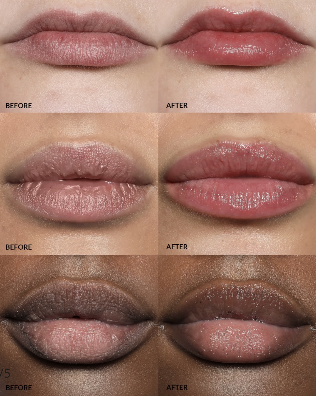 لیپ باف Refy Beauty